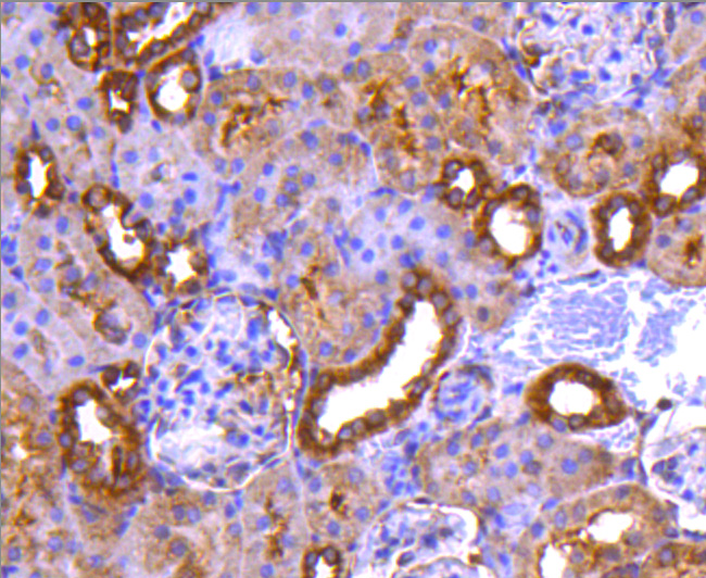 PP2A alpha + beta Rabbit mAb[4