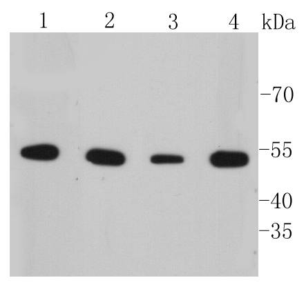 Cytokeratin 7 Rabbit mAb[48899