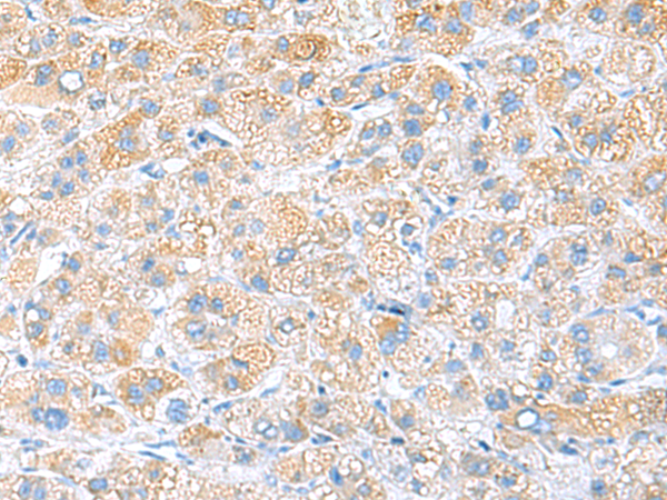 RPS16 Antibody[47438]