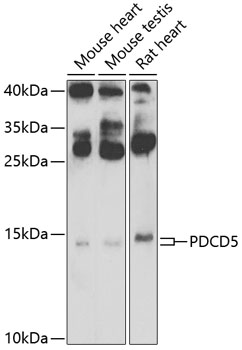 PDCD5 Polyclonal Antibody[3088