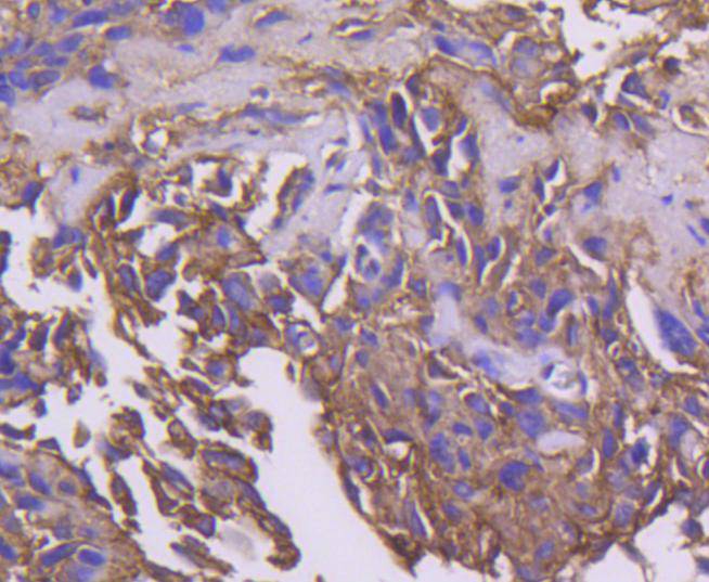 PDPK1 Rabbit mAb[49136]