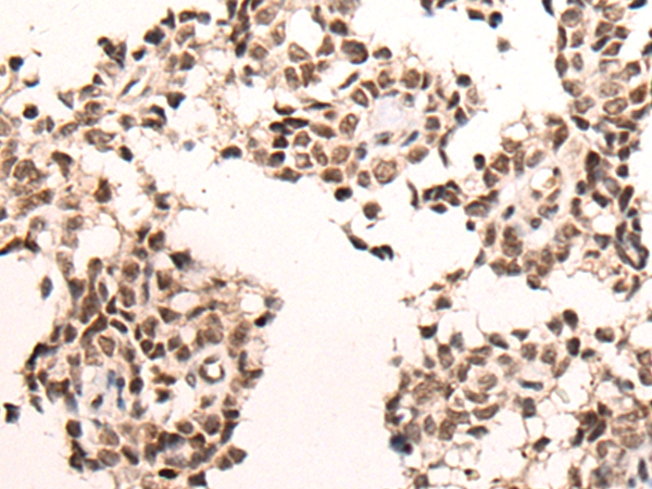 CACNA1H Antibody[46383]