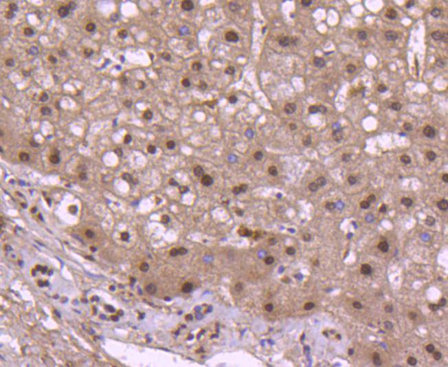 Histone H2B Rabbit mAb[49134]
