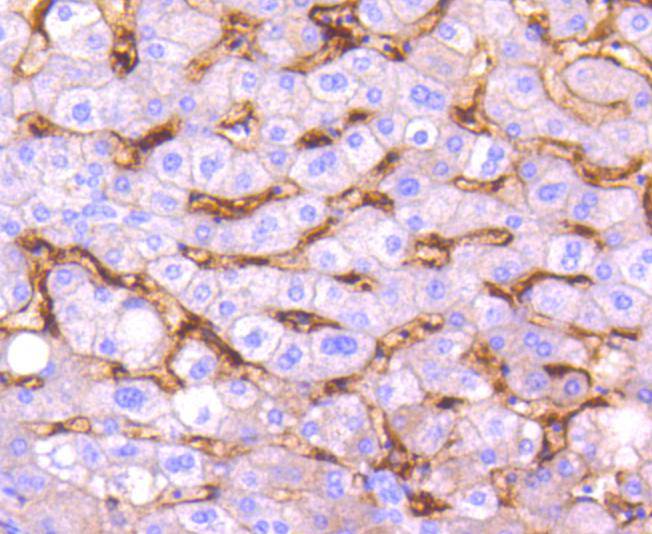 CD14 Rabbit mAb[49003]
