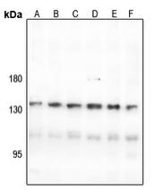 CNGB1 Antibody[47874]