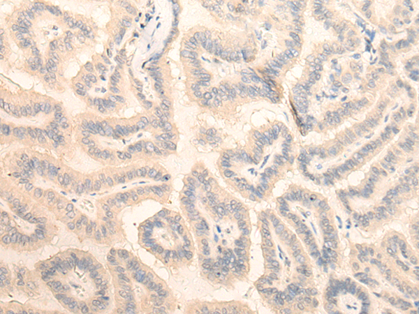 FAM98A Antibody[47121]