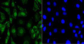 Eftud2 Antibody[48121]