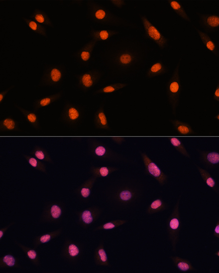 CHD4 Polyclonal Antibody[29086