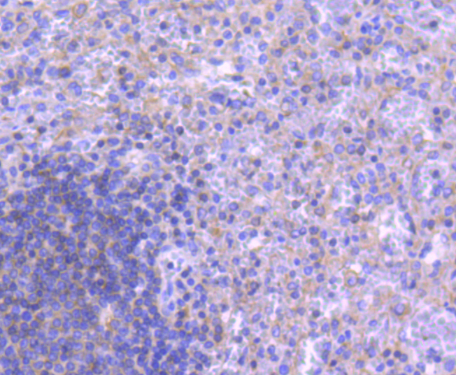 ATG5 Rabbit mAb[49050]
