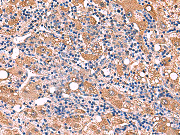FDXR antibody[31868]