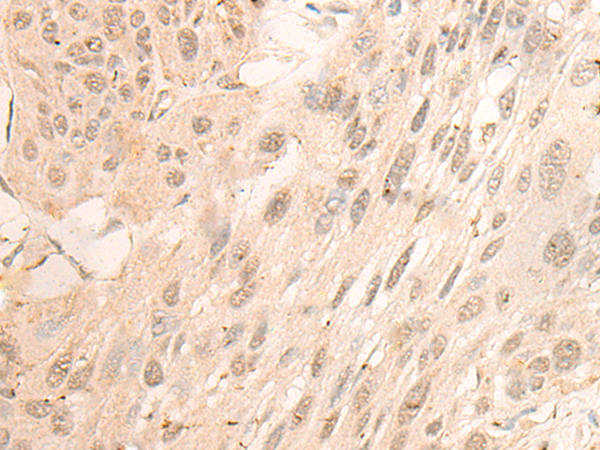 DDX50 Antibody[47041]