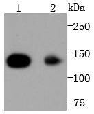 HDAC4 Rabbit mAb[49163]