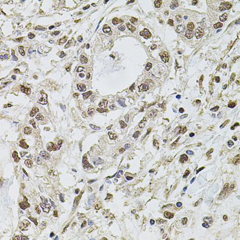 SET Polyclonal Antibody[29117]