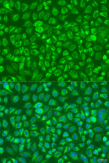 C5 Polyclonal Antibody[31439]
