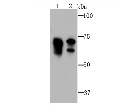 Metadherin(LYRIC) Antibody[482