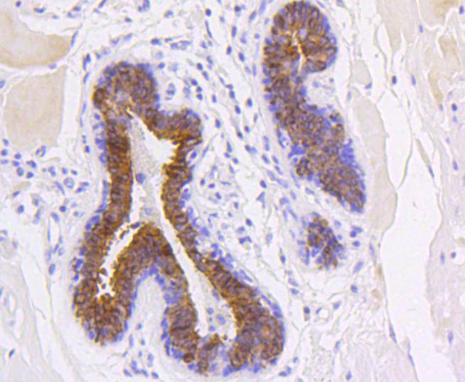 Cytokeratin 19 Rabbit mAb[4862