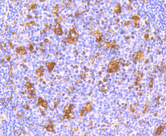 IFNAR1 Rabbit mAb[48656]