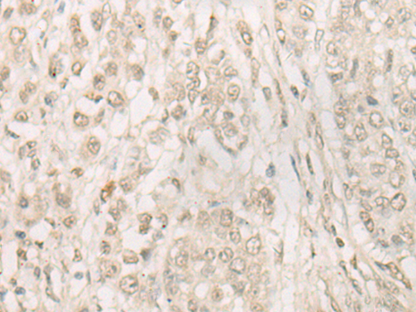 FSD1 Antibody[47123]