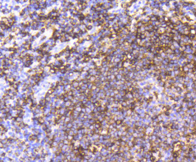 CD20 Rabbit mAb[48726]