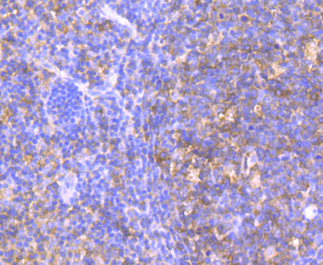 HPRT Rabbit mAb[49696]