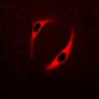 NT5C3 Antibody[47841]