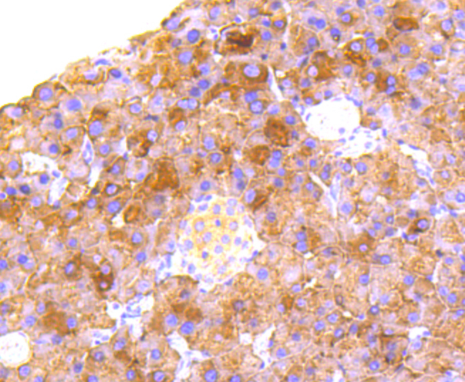 RALBP1 Rabbit mAb[49006]