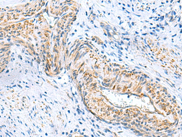 MYL1 Antibody[47440]