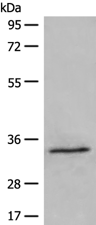 DIMT1 Antibody[47053]