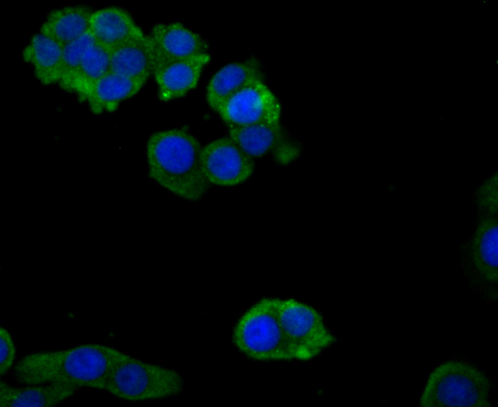 Zyxin Rabbit mAb[49705]
