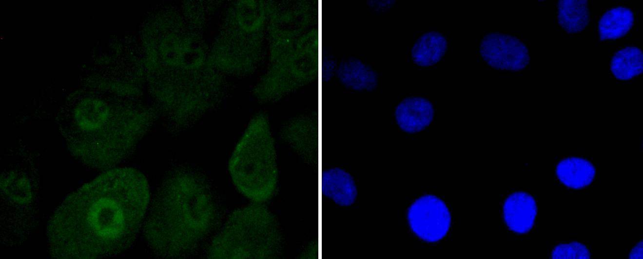 Musashi 1 Rabbit mAb[48764]