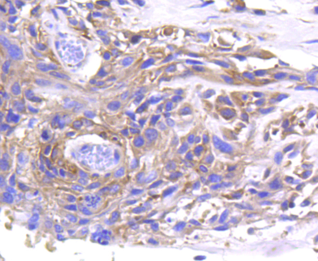 MMP11 Rabbit mAb[49045]