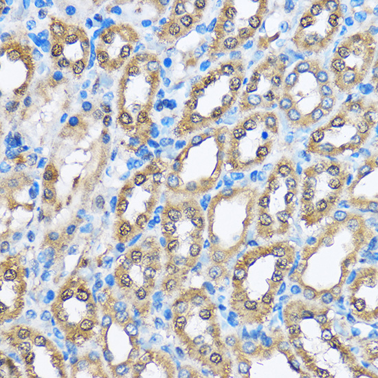 EGLN1 Polyclonal Antibody[2862