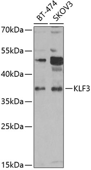 KLF3 Polyclonal Antibody[30846