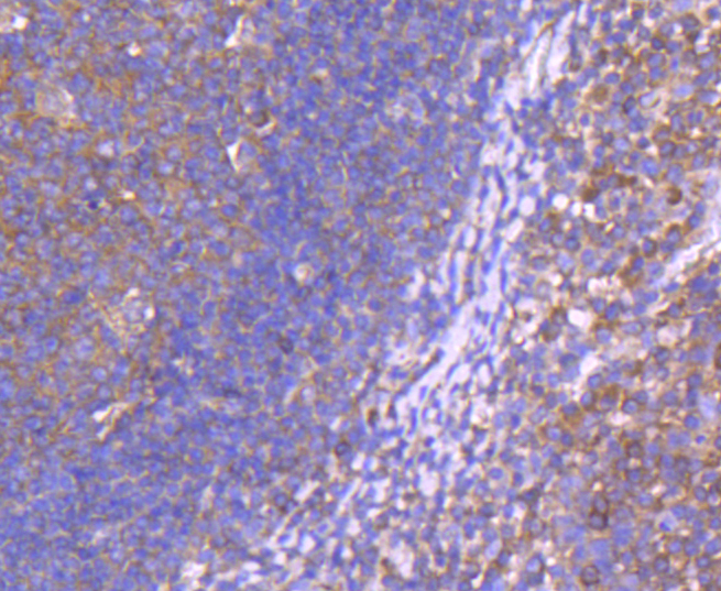CD10 Rabbit mAb[49098]