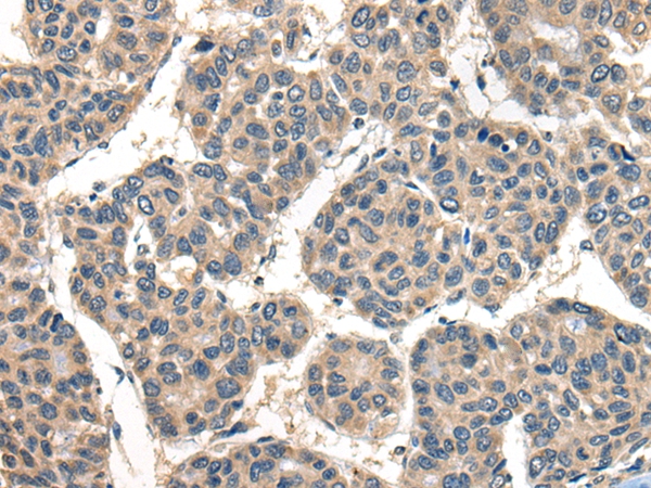 TACR3 Antibody[46680]