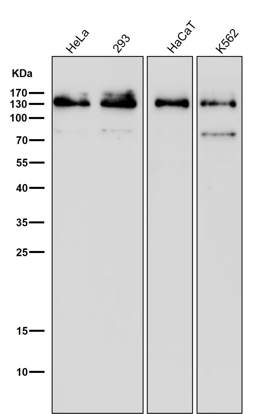 MGEA5 Rabbit mAb[49964]
