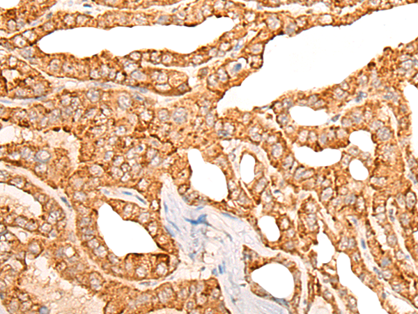 COX4I2 Antibody[46975]