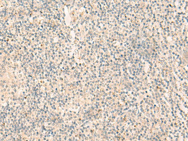 NGEF Antibody[47316]