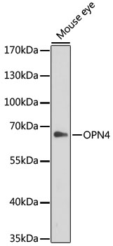 OPN4 Polyclonal Antibody[29798