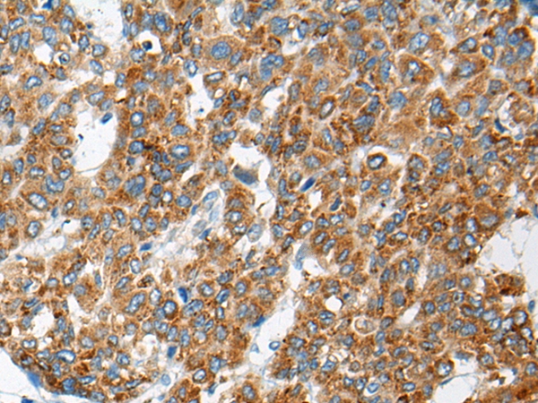 CEP104 Antibody[46473]