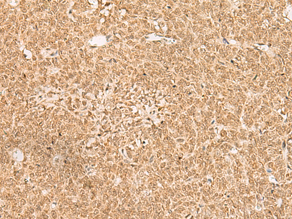 EXD2 Antibody[47304]