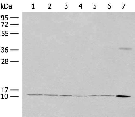 RPS27L Antibody[47263]