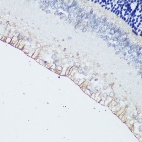 OPN4 Polyclonal Antibody[29798