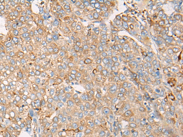 CAPN9 Antibody[46401]