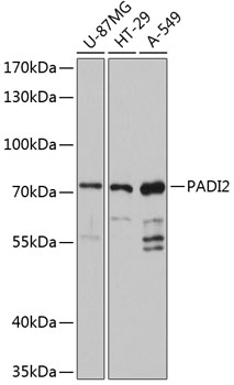 PADI2 Polyclonal Antibody[2765