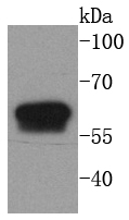Cytokeratin 6 Rabbit mAb[49086