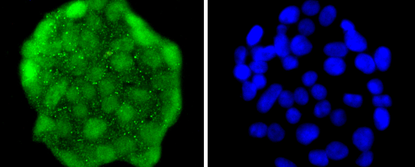 Hes1 Rabbit mAb[49016]