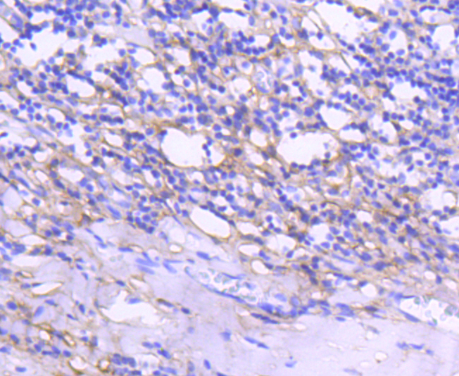 Tenascin C Rabbit mAb[48835]