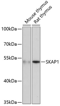 SKAP1 Polyclonal Antibody[3044
