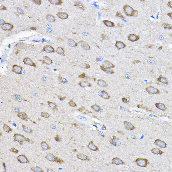 PTPN23 Polyclonal Antibody[305